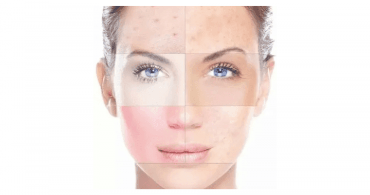 Ergebnisse spezieller Behandlungen results of the special treatments