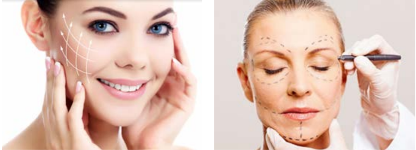 Liquid Face Lift